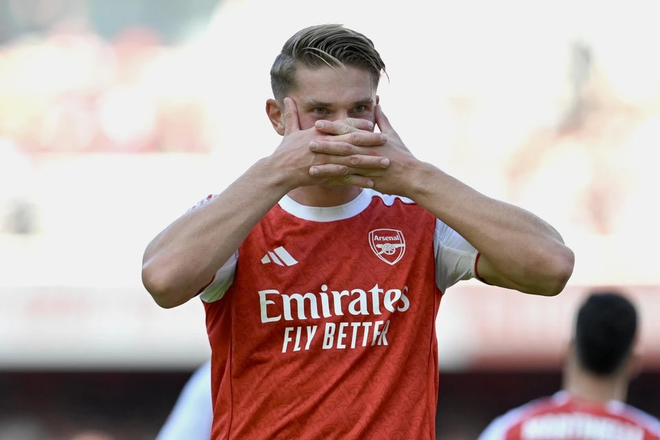 预计这位瑞, 手需要在今, 与曼联的 预计这位瑞, 手需要在今, 与曼联的